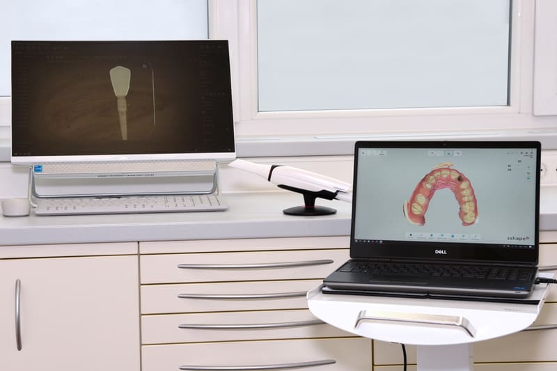 Digitale Zahnmedizin: Intraoralscanner und 3D-Planung am Bildschirm